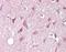 Zinc Finger And BTB Domain Containing 6 antibody, orb95585, Biorbyt, Immunohistochemistry paraffin image 
