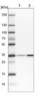 Ribosomal Protein L5 antibody, NBP1-92347, Novus Biologicals, Western Blot image 