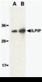STE20 Related Adaptor Beta antibody, A05271, Boster Biological Technology, Western Blot image 