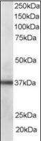 PDZ And LIM Domain 1 antibody, orb88192, Biorbyt, Western Blot image 