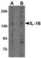 Interleukin 16 antibody, TA306708, Origene, Western Blot image 