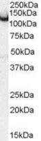 Amphiphysin antibody, GTX89317, GeneTex, Western Blot image 