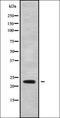 Cysteine Dioxygenase Type 1 antibody, orb336359, Biorbyt, Western Blot image 