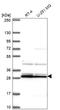 Guanylyl cyclase-activating protein 2 antibody, HPA055479, Atlas Antibodies, Western Blot image 