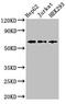 T-cell surface protein tactile antibody, CSB-PA004971LA01HU, Cusabio, Western Blot image 