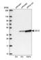Protein CDV3 antibody, NBP1-81781, Novus Biologicals, Western Blot image 