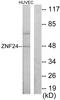 Zinc Finger Protein 24 antibody, LS-C118797, Lifespan Biosciences, Western Blot image 