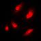 N(Alpha)-Acetyltransferase 15, NatA Auxiliary Subunit antibody, orb215298, Biorbyt, Immunofluorescence image 