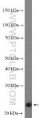 Cyclin Dependent Kinase Inhibitor 1B antibody, 25614-1-AP, Proteintech Group, Western Blot image 