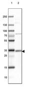 HLA class II histocompatibility antigen, DQ alpha 1 chain antibody, PA5-52927, Invitrogen Antibodies, Western Blot image 
