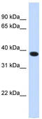 Acyl-CoA Binding Domain Containing 4 antibody, TA338669, Origene, Western Blot image 