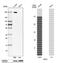 Neogenin 1 antibody, NBP1-89651, Novus Biologicals, Western Blot image 