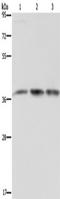 Calcium-binding protein 39 antibody, TA351407, Origene, Western Blot image 