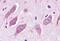 Estrogen Related Receptor Alpha antibody, GTX12985, GeneTex, Immunohistochemistry paraffin image 