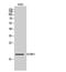 Putative beta-glucuronidase-like protein SMA3 antibody, A18107, Boster Biological Technology, Western Blot image 