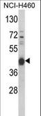 Protein Kinase CAMP-Activated Catalytic Subunit Alpha antibody, LS-C162147, Lifespan Biosciences, Western Blot image 