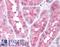 Hypoxia Inducible Factor 1 Subunit Alpha Inhibitor antibody, LS-C141145, Lifespan Biosciences, Immunohistochemistry paraffin image 