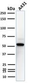 TOX High Mobility Group Box Family Member 3 antibody, GTX35139, GeneTex, Western Blot image 