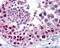 Metastasis Associated 1 Family Member 2 antibody, 48-911, ProSci, Immunohistochemistry paraffin image 
