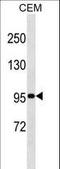 Ubiquitin carboxyl-terminal hydrolase 1 antibody, LS-C160465, Lifespan Biosciences, Western Blot image 