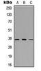 Growth Factor Independent 1B Transcriptional Repressor antibody, LS-B13660, Lifespan Biosciences, Western Blot image 