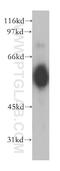 Cholinergic Receptor Nicotinic Alpha 5 Subunit antibody, 13516-1-AP, Proteintech Group, Western Blot image 