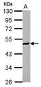 Zinc Finger Protein 322 antibody, NBP2-20990, Novus Biologicals, Western Blot image 