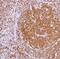 POU Class 2 Homeobox Associating Factor 1 antibody, MA5-16323, Invitrogen Antibodies, Immunohistochemistry frozen image 