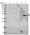 Adenosine Deaminase TRNA Specific 1 antibody, NBP1-85850, Novus Biologicals, Western Blot image 