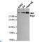 SWI/SNF Related, Matrix Associated, Actin Dependent Regulator Of Chromatin, Subfamily A, Member 4 antibody, LS-C812896, Lifespan Biosciences, Western Blot image 