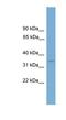 Lumican antibody, NBP1-79555, Novus Biologicals, Western Blot image 