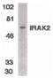 Interleukin 1 Receptor Associated Kinase 2 antibody, PA5-19937, Invitrogen Antibodies, Western Blot image 