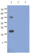 Synuclein Alpha antibody, GTX57587, GeneTex, Western Blot image 
