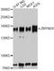 RACK7 antibody, STJ111394, St John