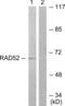 Dihydropyrimidinase Like 2 antibody, LS-B5657, Lifespan Biosciences, Western Blot image 