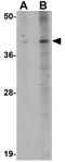 Phospholipid Phosphatase 5 antibody, GTX85223, GeneTex, Western Blot image 