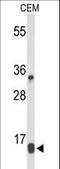 DIRAS Family GTPase 1 antibody, LS-C167420, Lifespan Biosciences, Western Blot image 