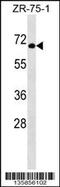 General Transcription Factor IIIC Subunit 5 antibody, 58-592, ProSci, Western Blot image 