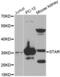 Steroidogenic Acute Regulatory Protein antibody, abx000970, Abbexa, Western Blot image 