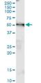 Alpha-1,3-Mannosyl-Glycoprotein 4-Beta-N-Acetylglucosaminyltransferase B antibody, H00011282-M01, Novus Biologicals, Western Blot image 