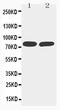 TNF Receptor Superfamily Member 1B antibody, PA5-80157, Invitrogen Antibodies, Western Blot image 