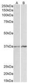 Annexin A1 antibody, NBP1-18842, Novus Biologicals, Western Blot image 