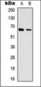 Eukaryotic Translation Initiation Factor 3 Subunit L antibody, orb376154, Biorbyt, Western Blot image 