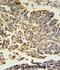 Heat Shock Protein Family B (Small) Member 1 antibody, abx033224, Abbexa, Immunohistochemistry paraffin image 