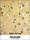 ARPC3 antibody, 62-355, ProSci, Immunohistochemistry paraffin image 