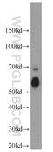 M-phase inducer phosphatase 3 antibody, 16485-1-AP, Proteintech Group, Western Blot image 