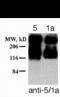 Glutamate Metabotropic Receptor 5 antibody, XPS-2018, ProSci, Western Blot image 