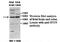 Interferon Induced Protein With Tetratricopeptide Repeats 5 antibody, MBS416087, MyBioSource, Western Blot image 