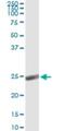 Alpha-1-acid glycoprotein antibody, H00005004-M01, Novus Biologicals, Immunoprecipitation image 