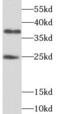 THAP Domain Containing 1 antibody, FNab08658, FineTest, Western Blot image 
